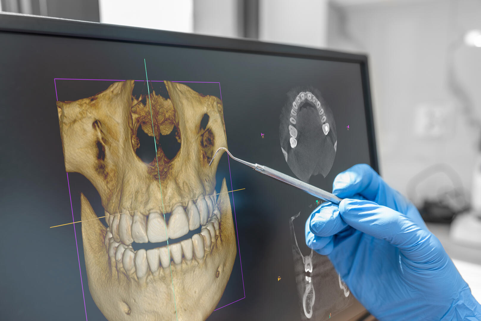 Dental consultation with 3D tomography image